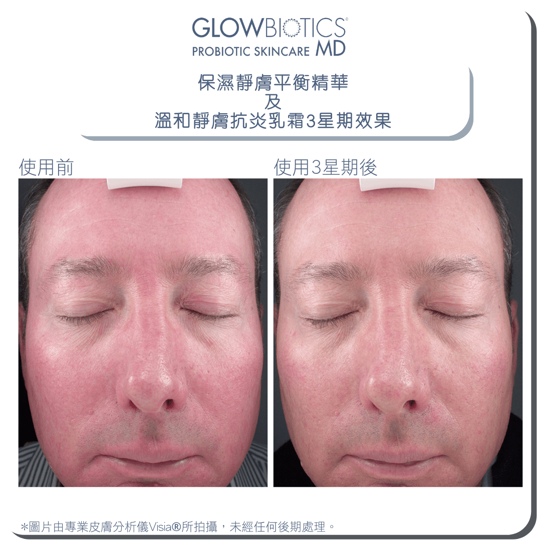 保濕靜膚平衡精華 - Glowbiotics HK